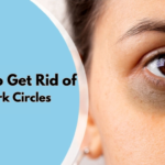 How to Get Rid of Dark Circles